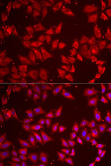 Immunohistochemistry - BAP1 Polyclonal Antibody (144-06533)