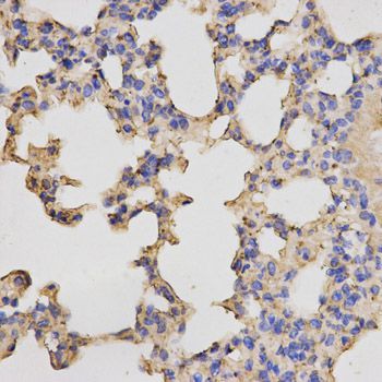 Immunohistochemistry - PRKACB antibody (144-05324)