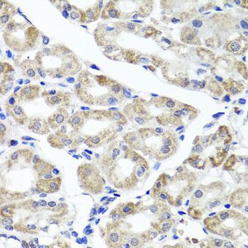 Immunohistochemistry - MAPKBP1 antibody (144-02626)