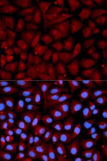 Immunofluorescence - SERPINC1 Polyclonal Antibody (144-01574)