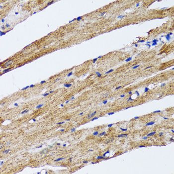Western blot - MAP1LC3B Polyclonal Antibody (144-07198)