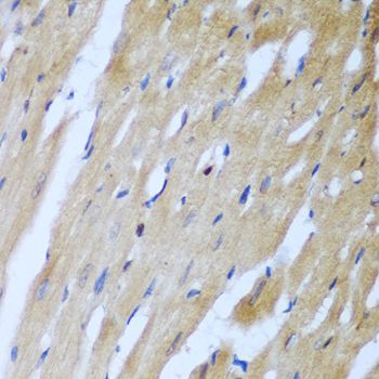 Western blot - [KO Validated] ROCK1 Polyclonal Antibody (144-01008)