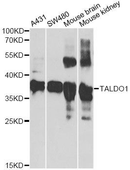 Western blot - TALDO1 antibody (144-06762)