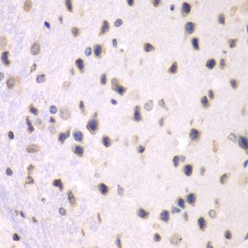 Immunohistochemistry - PRMT5 antibody (144-01520)