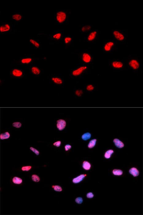 Immunofluorescence - Phospho-Rb-S811 antibody (144-50089)
