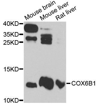 Western blot - COX6B1 antibody (144-012425)