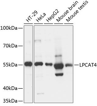 Western blot