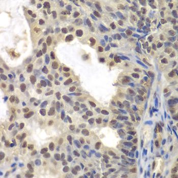 Immunohistochemistry - CENPC Polyclonal Antibody (144-06557)