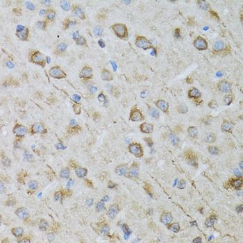 Immunohistochemistry - CRYM antibody (144-03810)