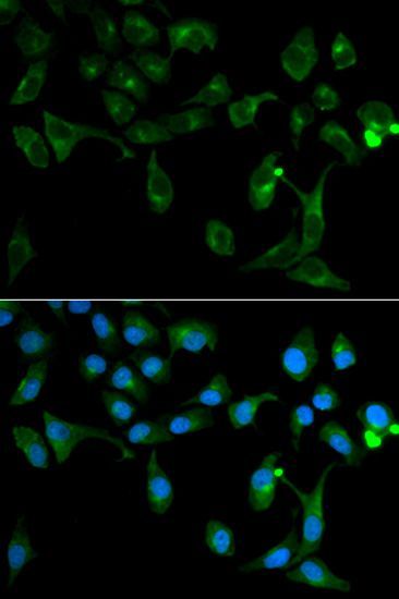 Immunofluorescence - TOLLIP antibody (144-02202)