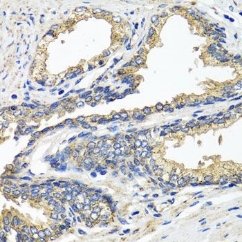 Immunohistochemistry - ETFA antibody (144-07670)