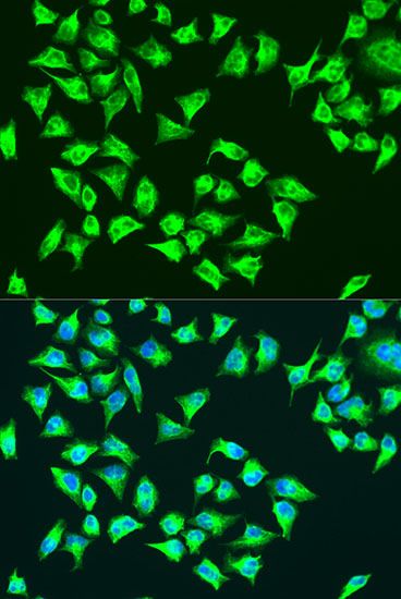 Immunofluorescence - ATP6 antibody (144-08193)