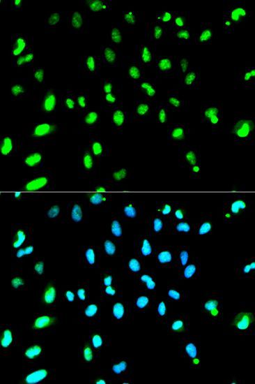 Immunohistochemistry - TARDBP Polyclonal Antibody (144-01183)