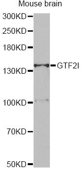 Western blot - GTF2I antibody (144-07898)
