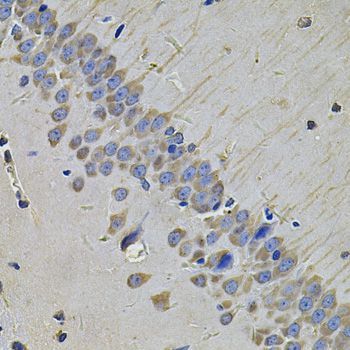 Immunohistochemistry - NAA50 Antibody (144-07387)