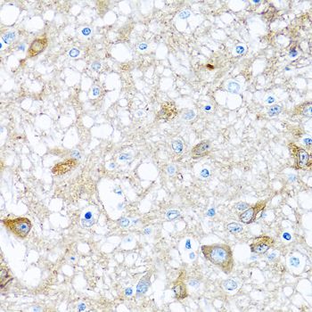 Immunohistochemistry - BMP5 Polyclonal Antibody (144-08401)