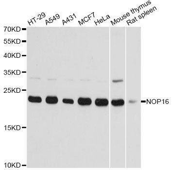 Western blot - NOP16 antibody (144-014128)