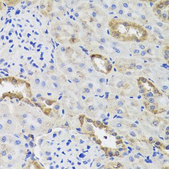 Immunohistochemistry - HK3 antibody (144-08428)