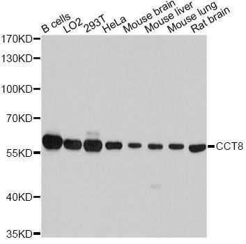 Western blot - CCT8 Polyclonal Antibody (144-04449)