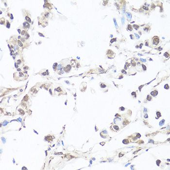 Immunohistochemistry - CASP3 Polyclonal Antibody (144-02156)