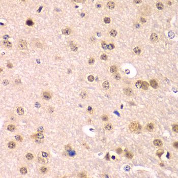 Immunohistochemistry - IKBKB antibody (144-02087)