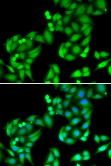 Immunofluorescence - COPS3 Polyclonal Antibody (144-07017)