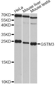 Western blot - GSTM3 antibody (144-03905)