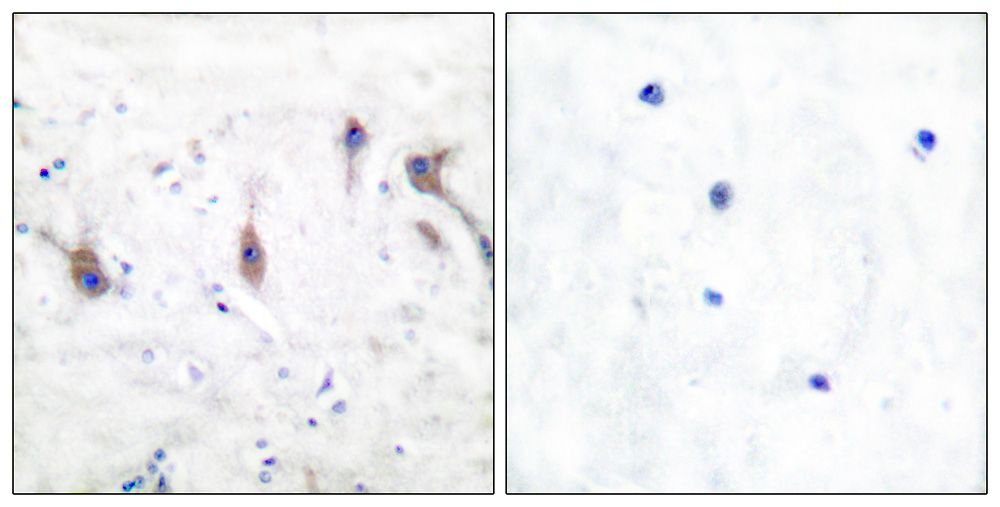IHC