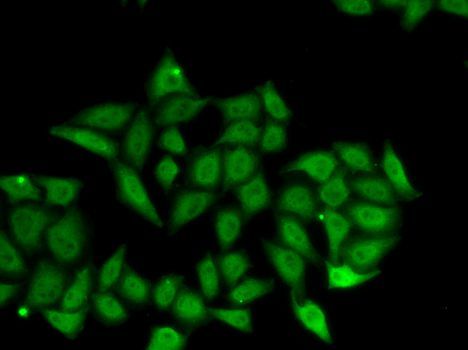 Immunofluorescence - IRF8 antibody (144-60440)