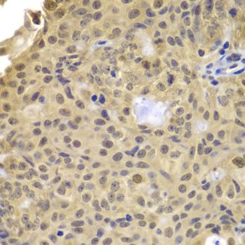 Immunohistochemistry - CCNA2 antibody (144-07632)