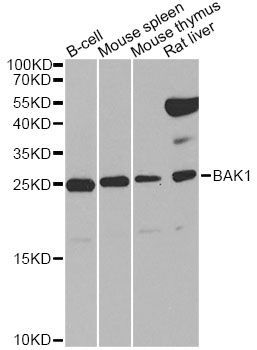 Western blot - BAK1 Polyclonal Antibody (144-00204)
