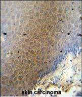 IHC-P