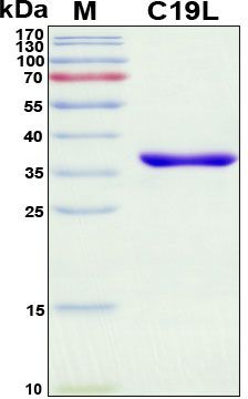 SDS-PAGE
