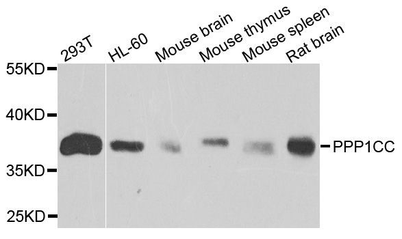 Western blot - [KO Validated] PPP1CC Polyclonal Antibody (144-04035)