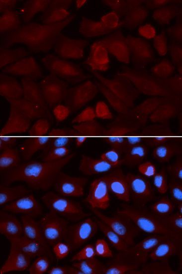 Immunofluorescence - ALDH3A1 antibody (144-05502)