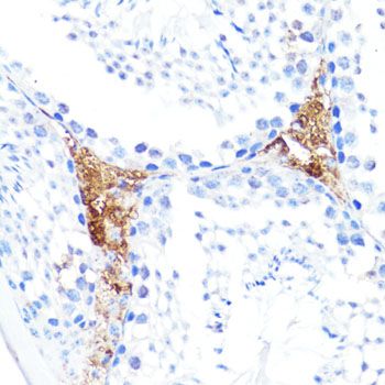Immunohistochemistry - S100A10 antibody (144-60742)
