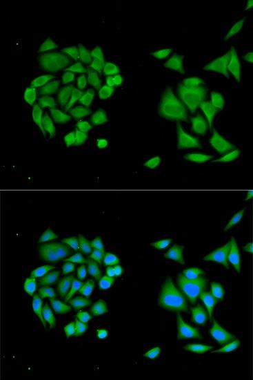 Immunofluorescence - DDX58 Polyclonal Antibody (144-00550)