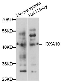 Western blot - HOXA10 antibody (144-08550)