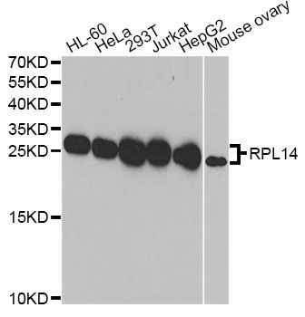 Western blot - RPL14 Polyclonal Antibody (144-06724)