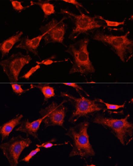 Immunofluorescence - IRAK1 antibody (144-600844)