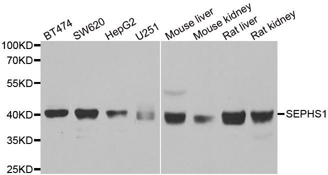 Western blot - SEPHS1 Polyclonal Antibody (144-013403)
