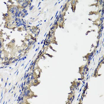 Immunohistochemistry - OTC antibody (144-09834)