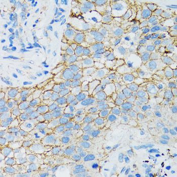 Immunohistochemistry - CTNNA1 Polyclonal Antibody (144-05635)