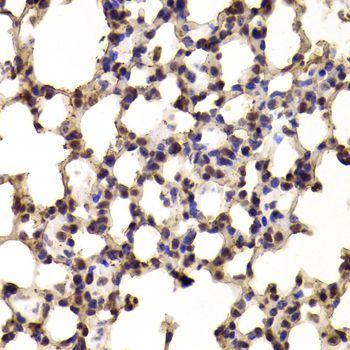 Immunohistochemistry - BHLHE40 Polyclonal Antibody (144-06534)