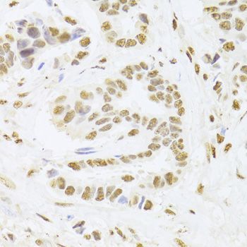 Immunohistochemistry - ANP32A Antibody (144-05768)