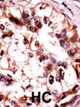 IHC-P