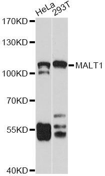 Western blot - MALT1 antibody (144-02144)