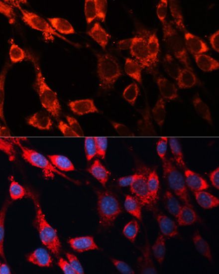 Immunofluorescence - CASP3 Polyclonal Antibody (144-02156)