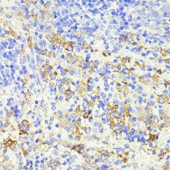 Immunohistochemistry - CD44 Polyclonal Antibody (144-00340)