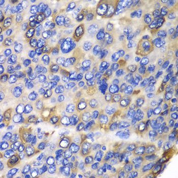 Immunohistochemistry - CES1 antibody (144-01853)